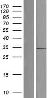 Human EEF2KMT / FAM86A Protein (Over-Expression Lysate Myc-DDK (Flag))