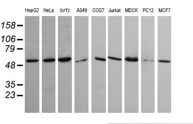 TRIM45 Antibody (clone OTI4F1)