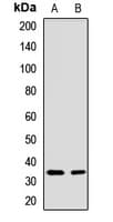 ATP1B1 Antibody