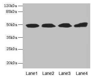 TBCEL / E-Like Antibody (aa1-424)