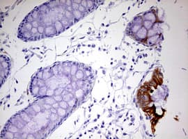 KRT20 / CK20 / Cytokeratin 20 Antibody (clone OTI4B4)