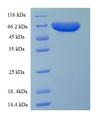 Rat PKLR Protein (Recombinant His)