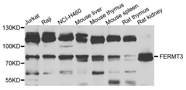 URP2 / FERMT3 Antibody