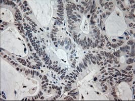 Prominin 2 / PROM2 Antibody (clone OTI6B7)