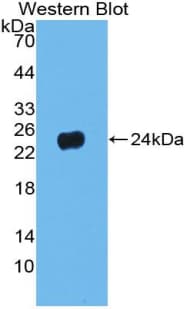 PNOC / Nociceptin Antibody (aa12-187)