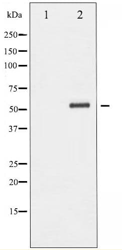 CHEK2 / CHK2 Antibody (phospho-Thr68)