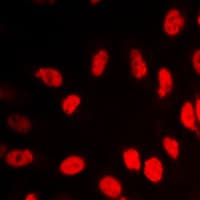 Polyclonal Rabbit anti-Human Vitamin D Receptor / VDR Antibody (aa196-235, IHC, IF, WB)
