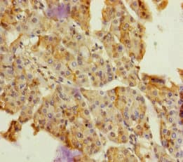 Polyclonal Rabbit anti-Human Dermatopontin / DPT Antibody (IHC)