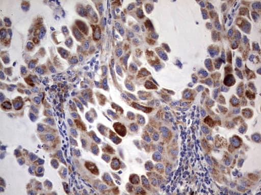 Monoclonal Mouse anti-Human ACE2 / ACE-2 Antibody (clone OTI4D2, aa18-237, IHC, WB)