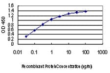 MAPK6 / ERK3 Antibody (clone 1G6)