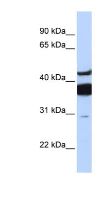 L3 / LASS2 Antibody (aa72-121)