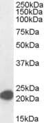 PathPlus™ MAX Antibody (aa147-160)