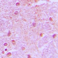 Polyclonal Rabbit anti-Human GRG4 / TLE4 Antibody (Internal, IHC, WB)