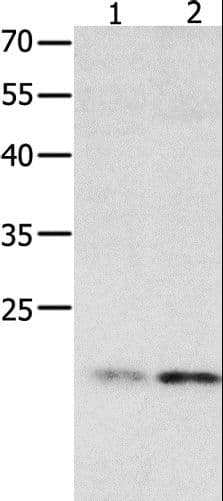 HMGB4 Antibody