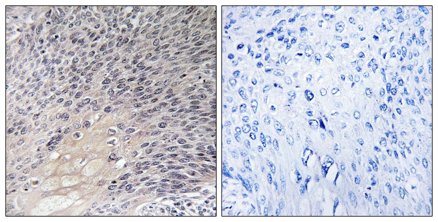 ARHGDIA / RHOGDI Antibody (Ab-174)