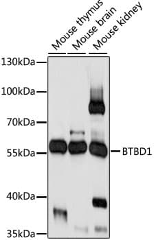 Polyclonal Rabbit anti-Human BTBD1 Antibody (WB)