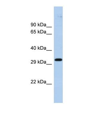 Polyclonal Rabbit anti-Human ZNF397 Antibody (aa51-100, WB)