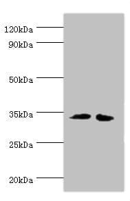 Polyclonal Rabbit anti-Human RPH3AL Antibody (aa161-315, IHC, WB)