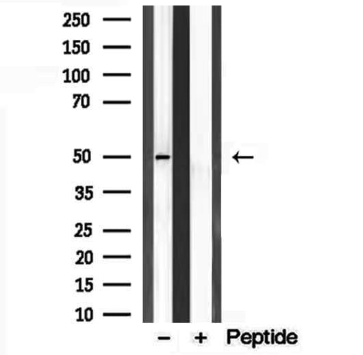 Polyclonal Rabbit anti-Human C9orf72 / ALSFTD Antibody (IHC, WB)