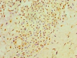 Polyclonal Rabbit anti-Human NXNL1 / TXNL6 Antibody (aa1-200, IHC)