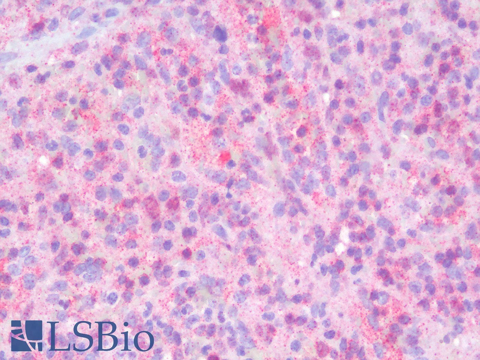 PathPlus™ CD2 Antibody
