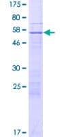 Human ZNF781 Protein (Recombinant GST)