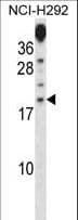 Polyclonal Rabbit anti-Human PRR15 Antibody (aa71-100, WB)