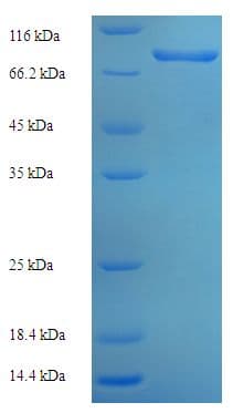 Human P4HA3 Protein (Recombinant His-SUMO)