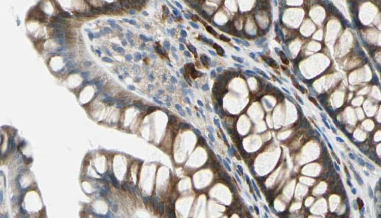 BTBD6 Antibody