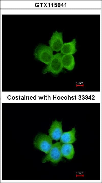 Polyclonal Rabbit anti-Human CACYBP Antibody (aa1-228, WB)