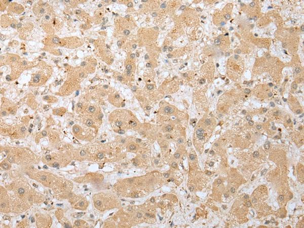 DHRSX Antibody