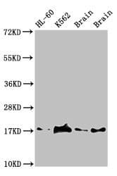 MMS2 / UBE2V2 Antibody