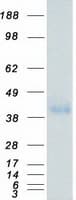 Human CD32B Protein (Recombinant Myc-DDK (Flag))