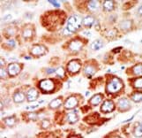 AK1 / Adenylate Kinase 1 Antibody (aa165-194)