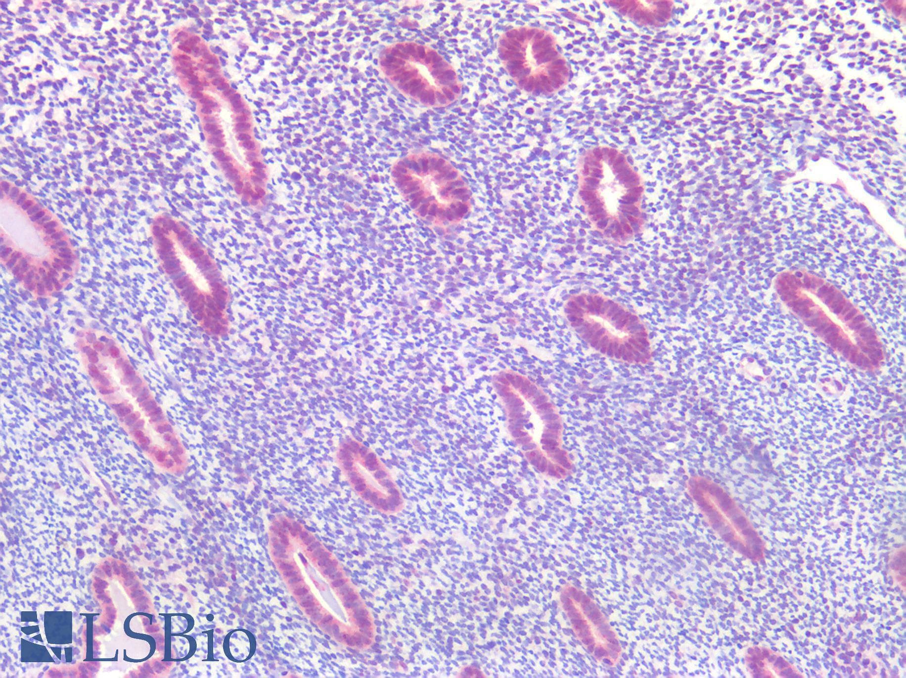 PathPlus™ FOXO1 / FKHR Antibody