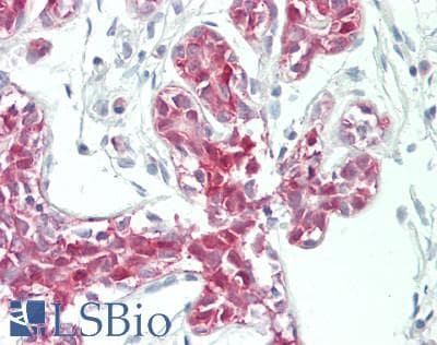 IHC-plus™ SMAD3 Antibody (aa170-219)