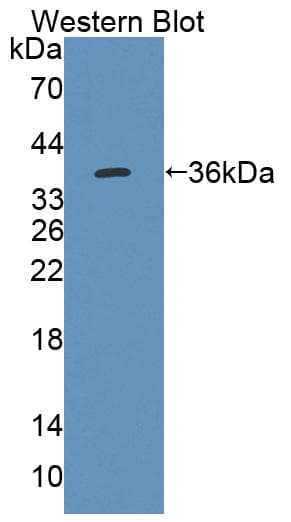 ACAA2 Antibody