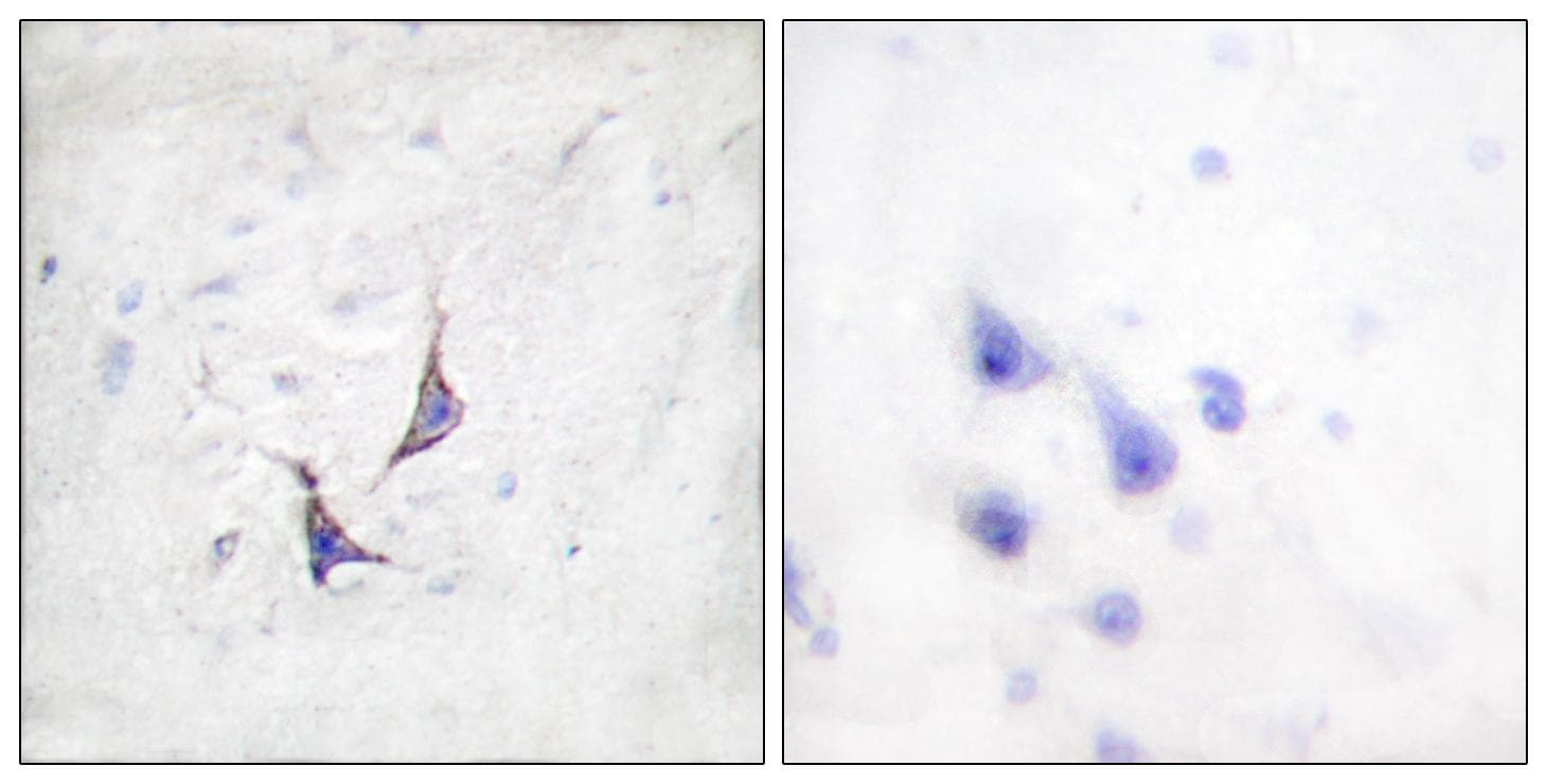 SDC4 / Syndecan 4 Antibody (p179)