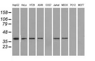 IDH3A Antibody (clone OTI2F11)