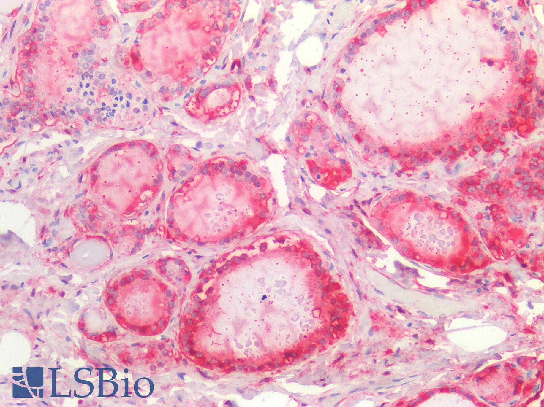 PathPlus™ ALDH1A1 / ALDH1 Antibody
