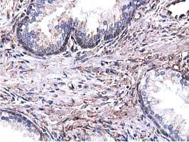 CYB5R3 / B5R Antibody (clone OTI2A10)