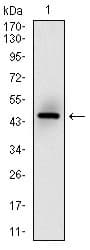 IHC-plus™ Monoclonal Mouse anti-Human MSH6 Antibody (clone 5B11, aa217-395, IHC, WB)