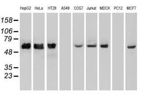 CHEK2 / CHK2 Antibody (clone OTI10G7)