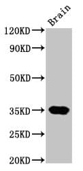 NKX3-2 / BAPX1 Antibody