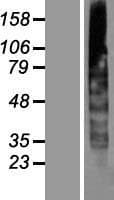CYB561A3 / CYBASC3 Protein (Over-Expression Lysate Myc-DDK (Flag))