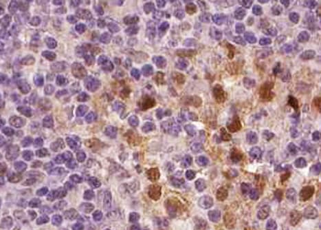 Polyclonal Rabbit anti-Human BCL2 / Bcl-2 Antibody (IHC, IF, WB)