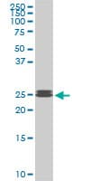 Monoclonal Mouse anti-Human PAFAH1B3 Antibody (clone 3G6, WB)
