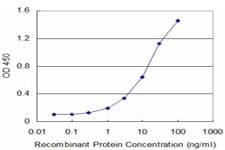 Monoclonal Mouse anti-Human TARBP2 / TRBP2 Antibody (clone 2H1, WB)