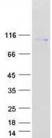 Human CEP85 / CCDC21 Protein (Recombinant Myc-DDK (Flag))