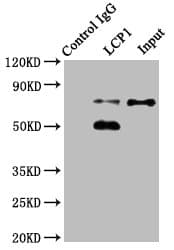 Polyclonal Rabbit anti-Human LCP1 / L-Plastin Antibody (aa2-627, IHC, WB)